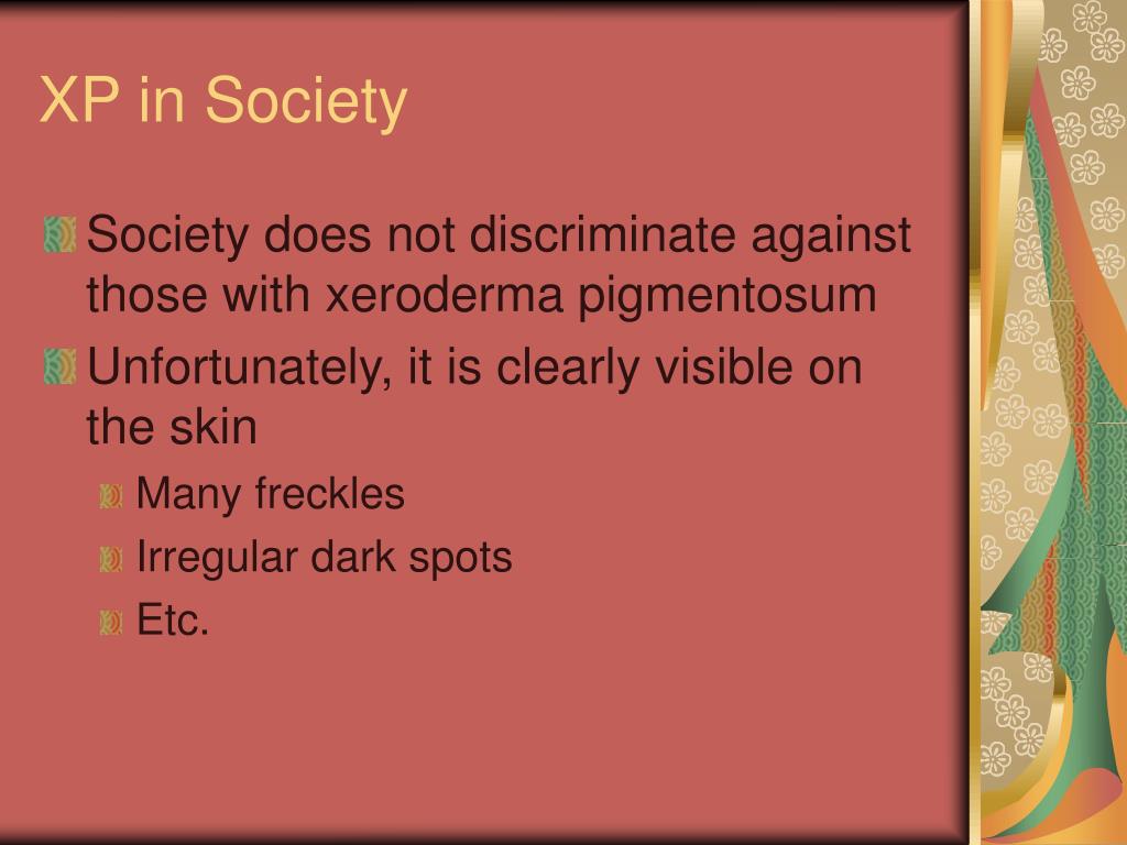Ppt Xeroderma Pigmentosum Powerpoint Presentation Free Download