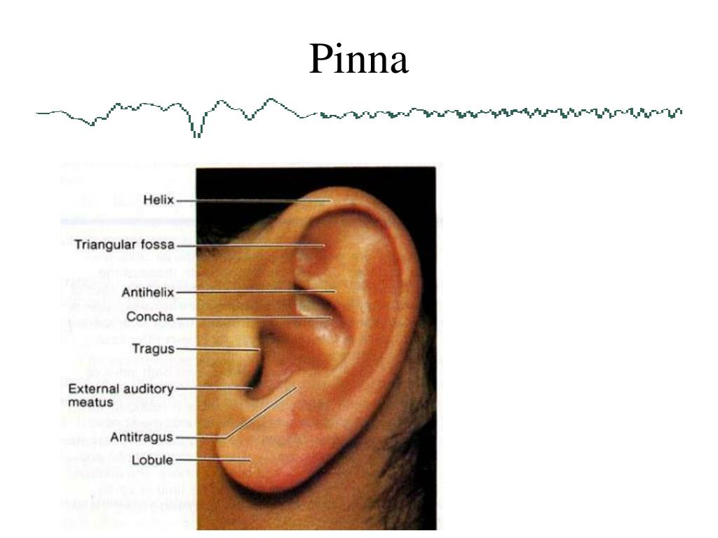 PPT Anatomy of the Ear PowerPoint Presentation, free download ID