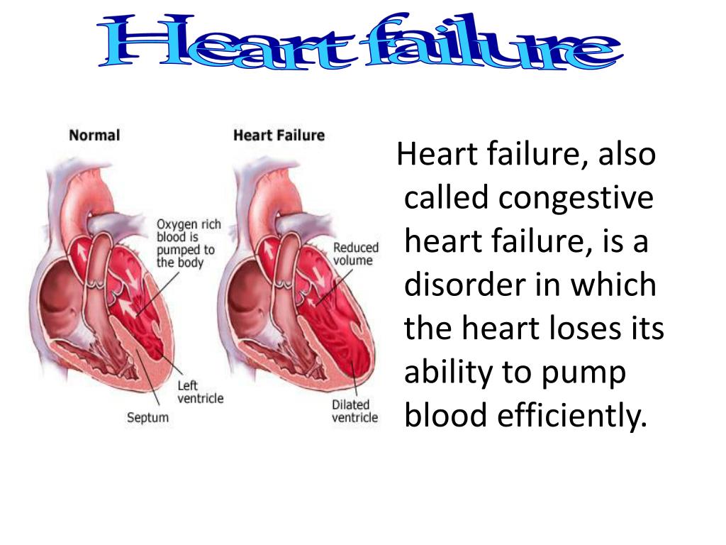 powerpoint presentation on heart failure