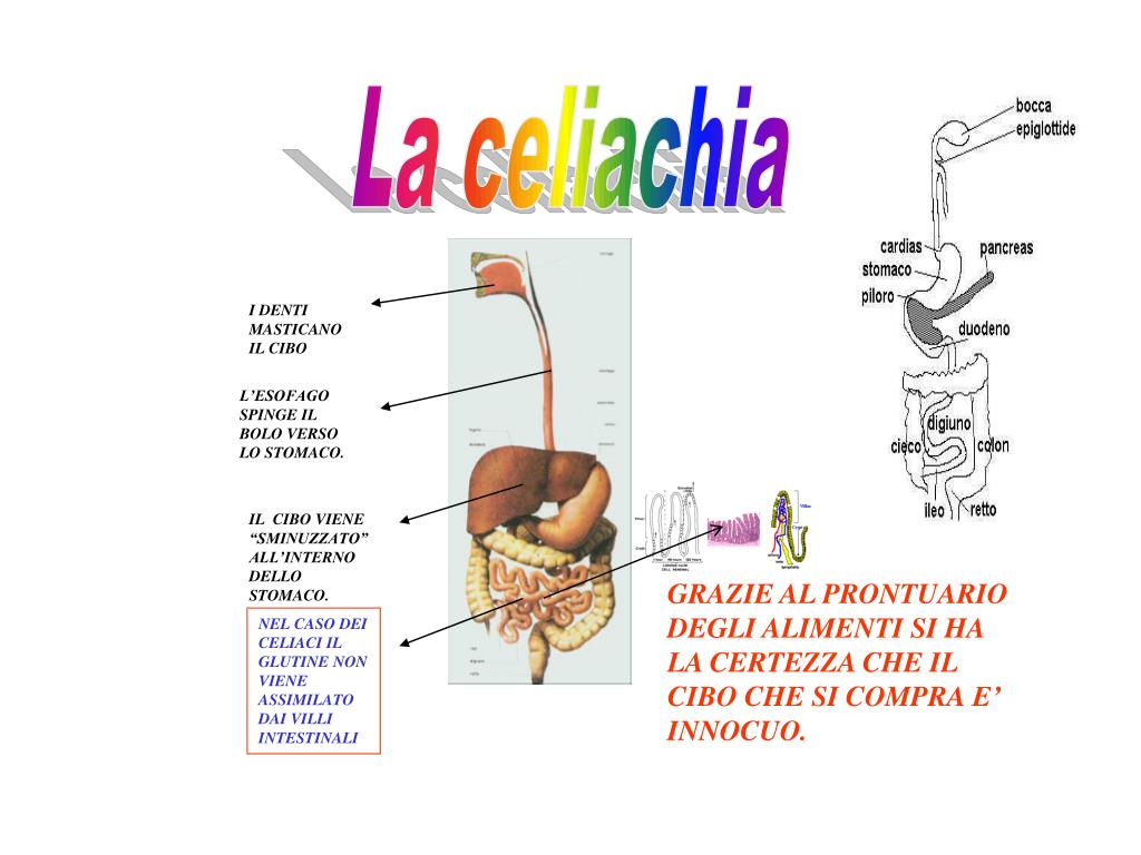 PPT La celiachia PowerPoint Presentation, free download ID4536075