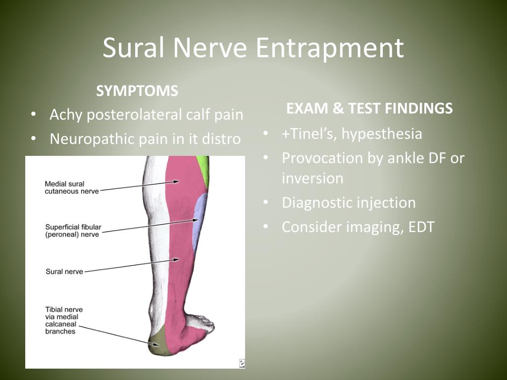 N suralis. Sural nerve икроножный нерв. Suralis нерв. Suralis нерв иннервирует. Suralis нерв анатомия.