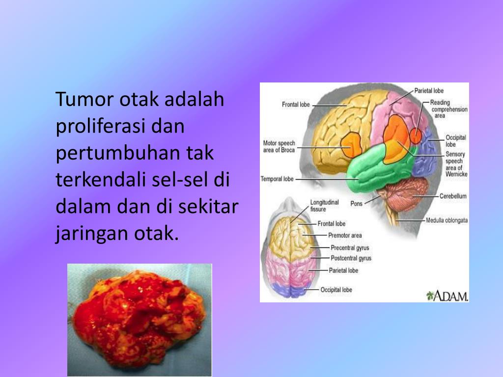 Sufijo qué significa tumor