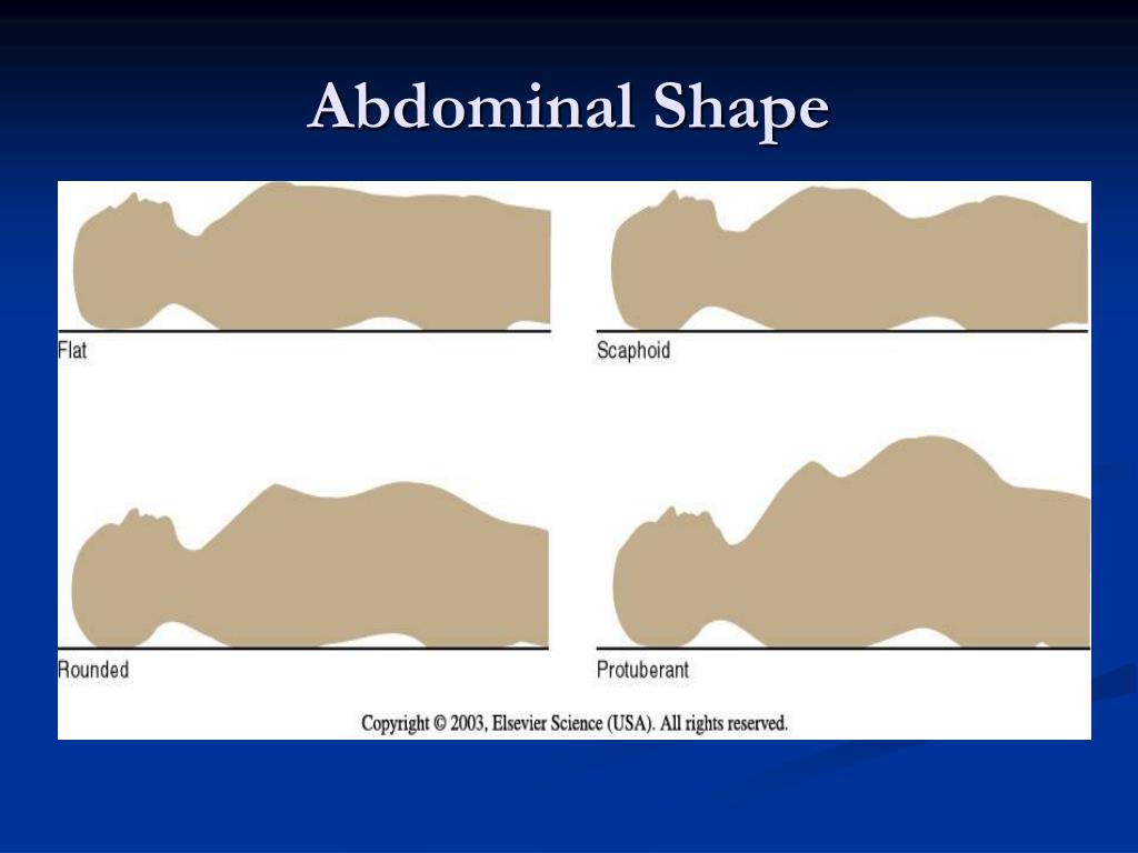 Scaphoid Shaped Abdomen