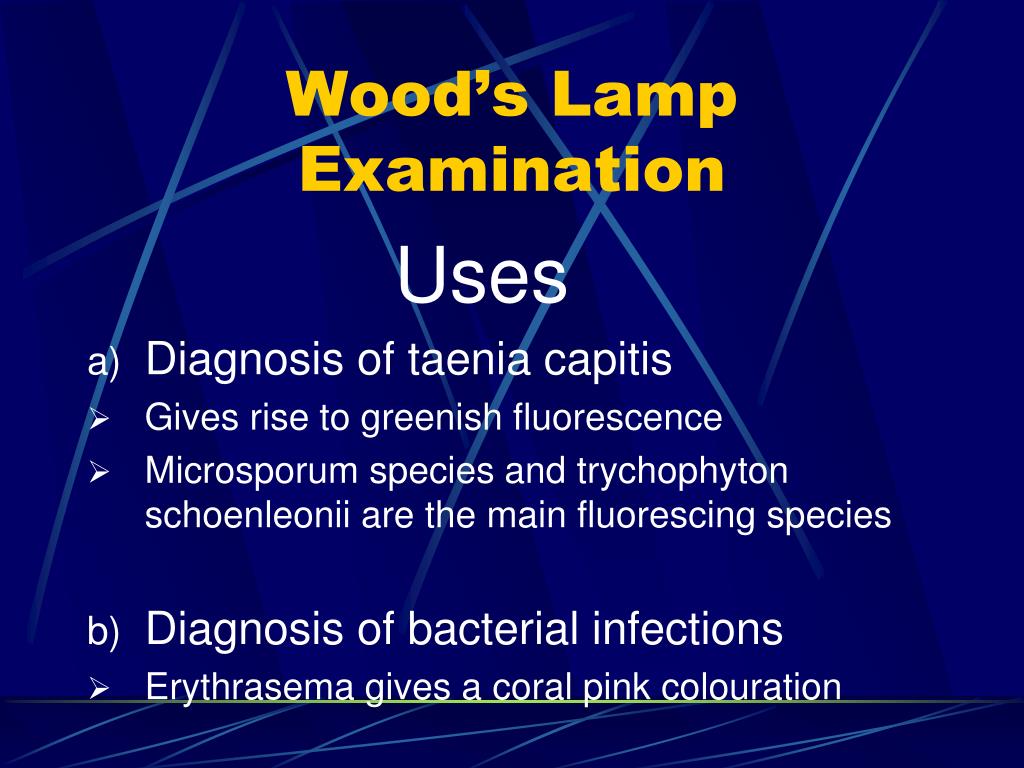 Wood lamp examination slideshare deals