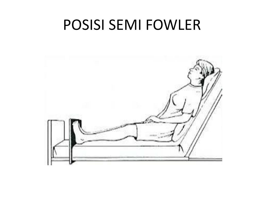 Cuál es la posición de fowler