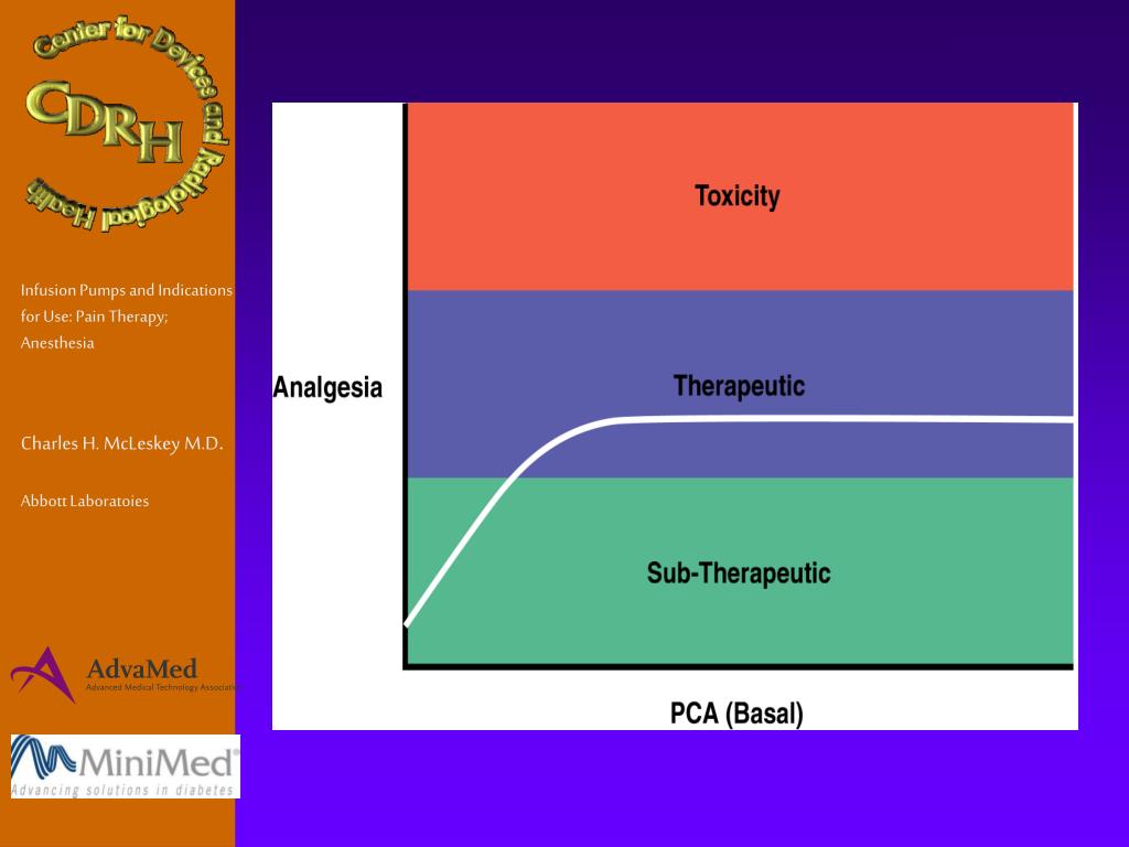 PPT Infusion Pumps and Indications for Use Pain Therapy; Anesthesia
