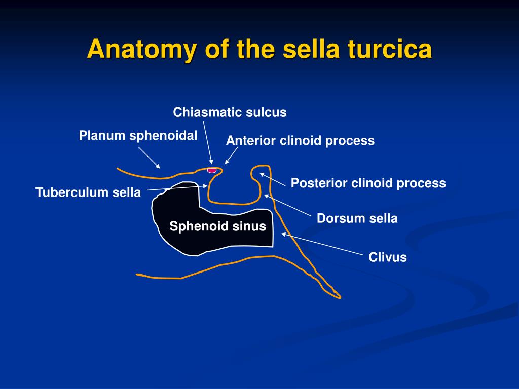 Sella Turcica Diagram