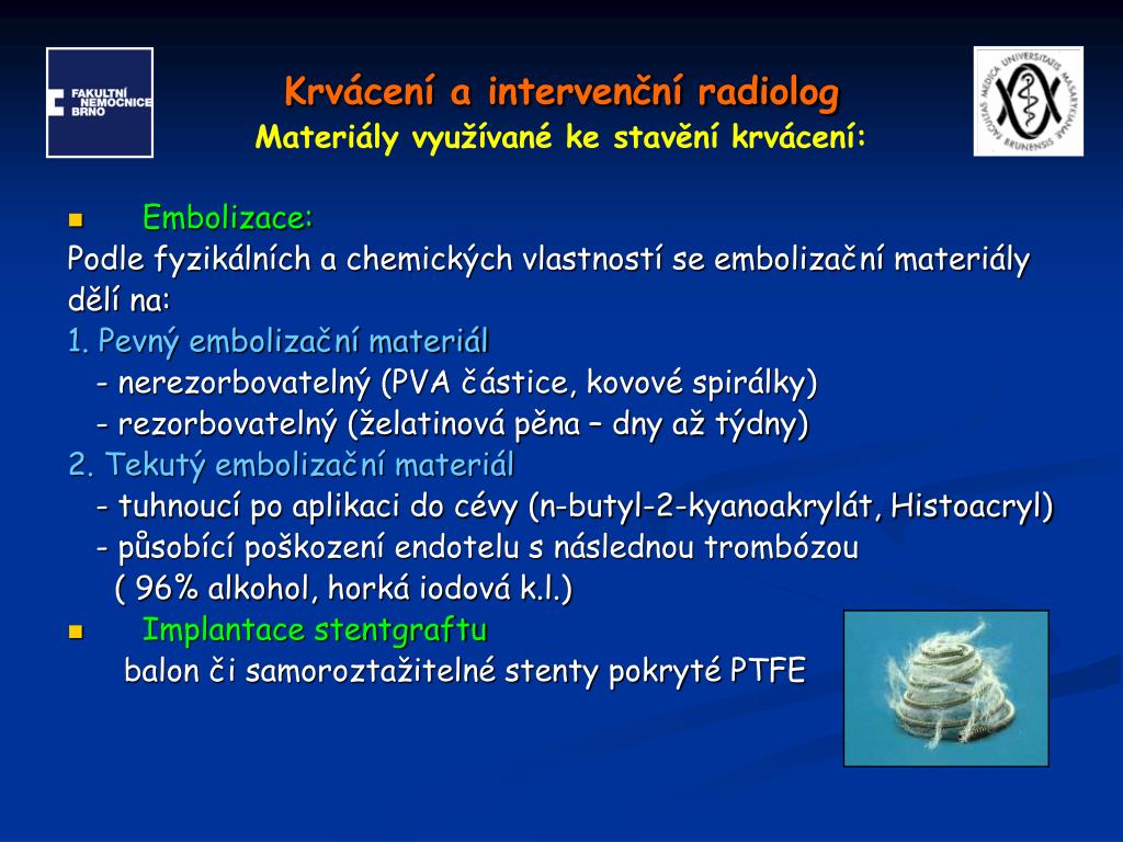 PPT - Krvácení a intervenční radiolog PowerPoint Presentation, free  download - ID:4571496