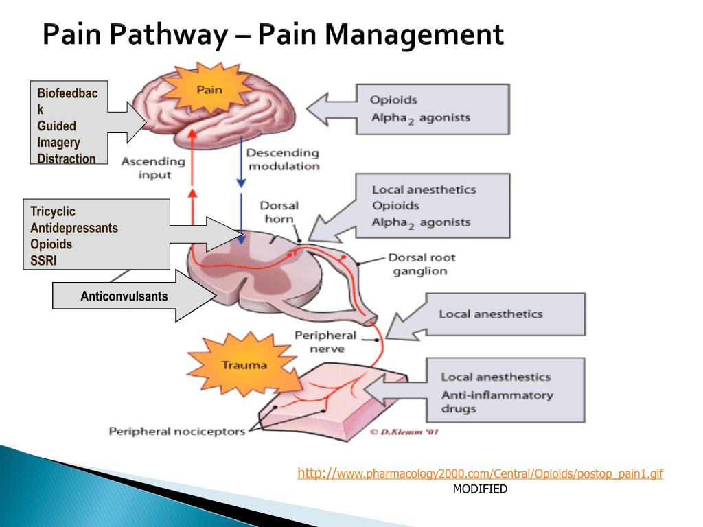 pain pathway คือ icd 10 code