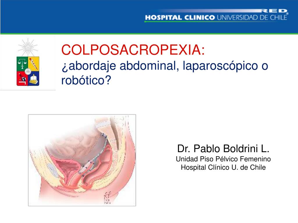 PPT - COLPOSACROPEXIA: ¿abordaje abdominal, laparoscópico o robótico?  PowerPoint Presentation - ID:4583482