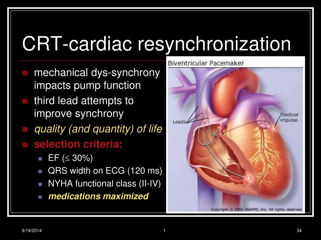 PPT - Heart Failure 101 PowerPoint Presentation, free download - ID:4586577