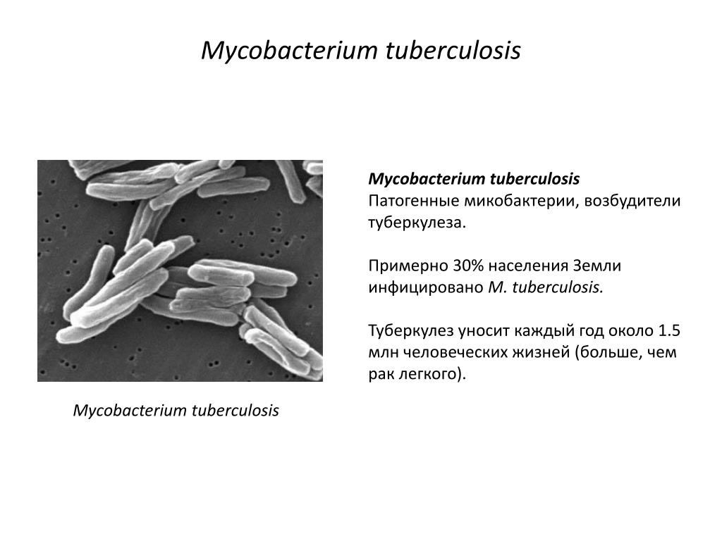 Возбудители туберкулеза тест