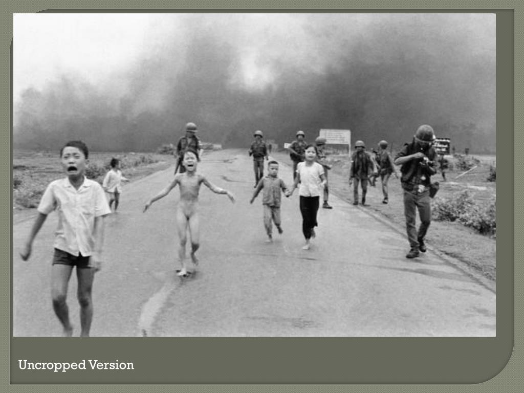 Vietnamese Woman Burned By Napalm Treated 40 Years Later 