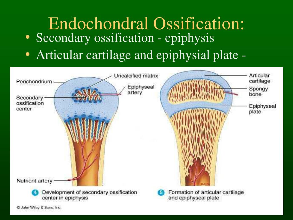 PPT - Bone Histology & Fracture Healing PowerPoint Presentation, free