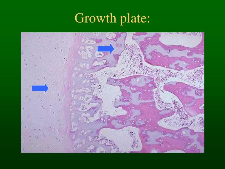 PPT - Bone Histology & Fracture Healing PowerPoint Presentation - ID