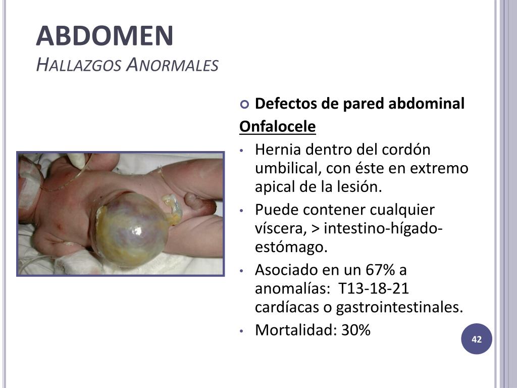 PPT Examen F sico Del Reci n Nacido PowerPoint Presentation Free 