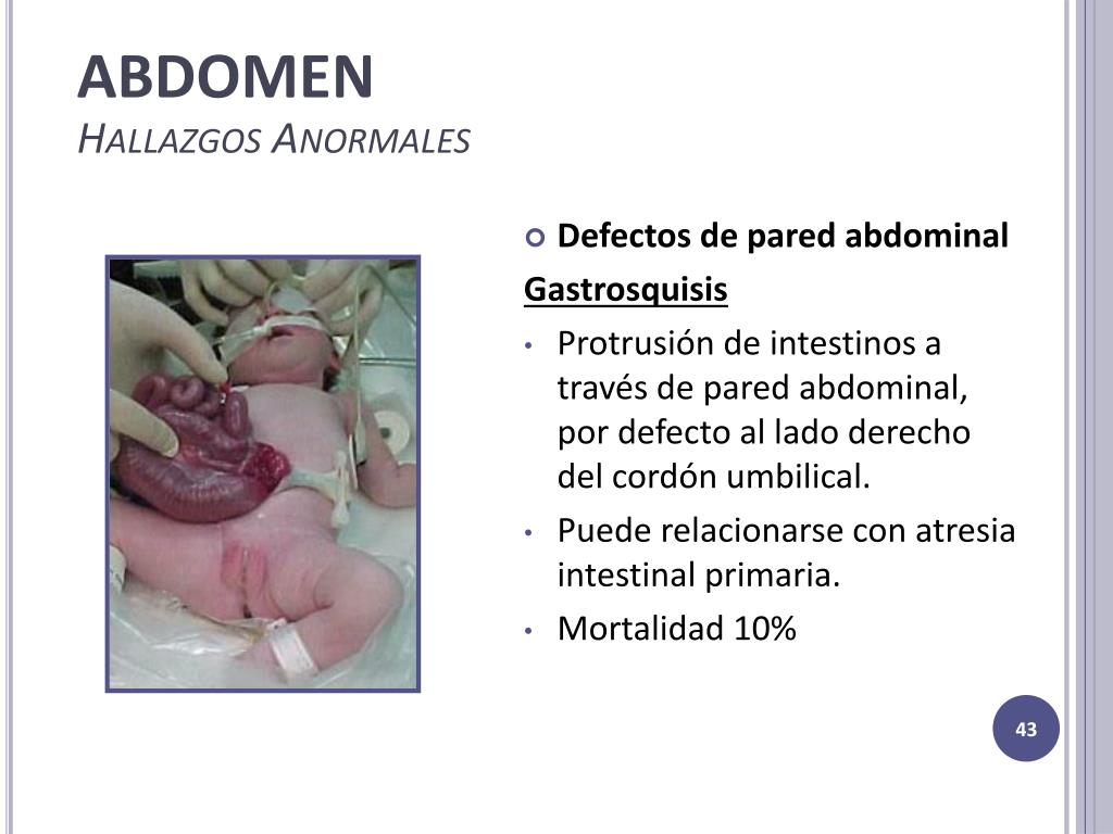 PPT Examen F sico Del Reci n Nacido PowerPoint Presentation Free 