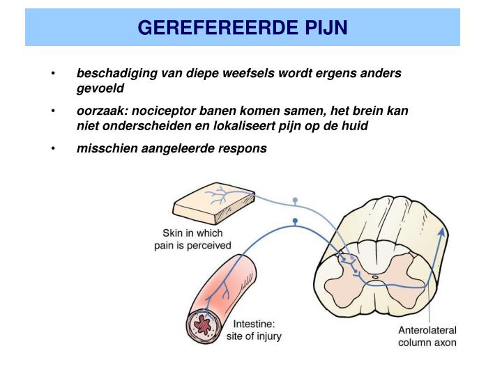 gerefereerde pijn