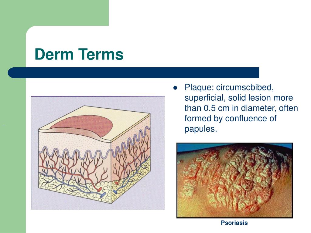 PPT Approach to Dermatology in the Emergency Department PowerPoint
