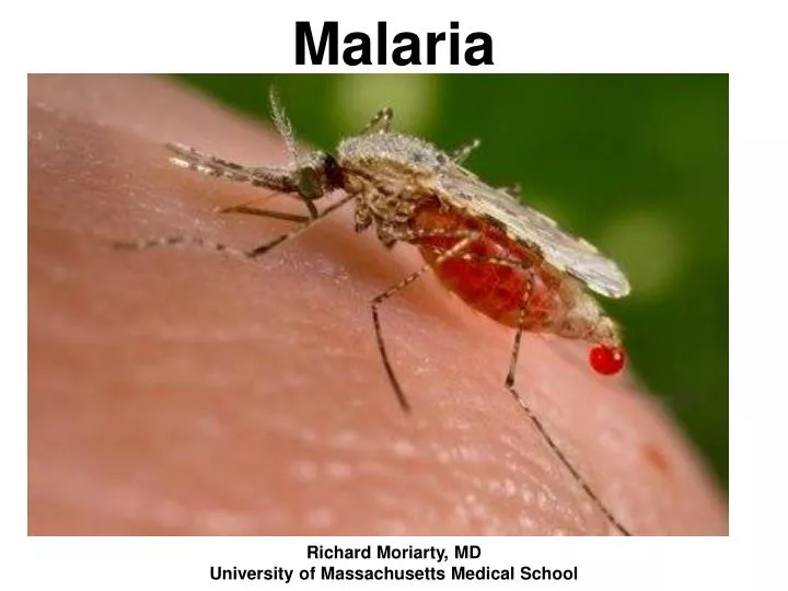 malaria n.