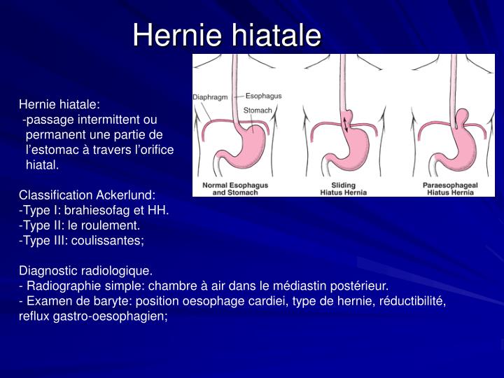 PPT Système digestif PowerPoint Presentation ID4600778