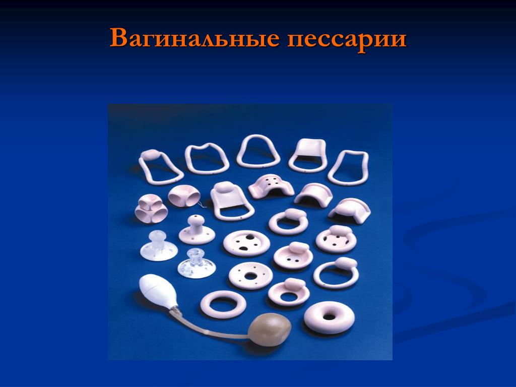 После установки пессария После установки пессария