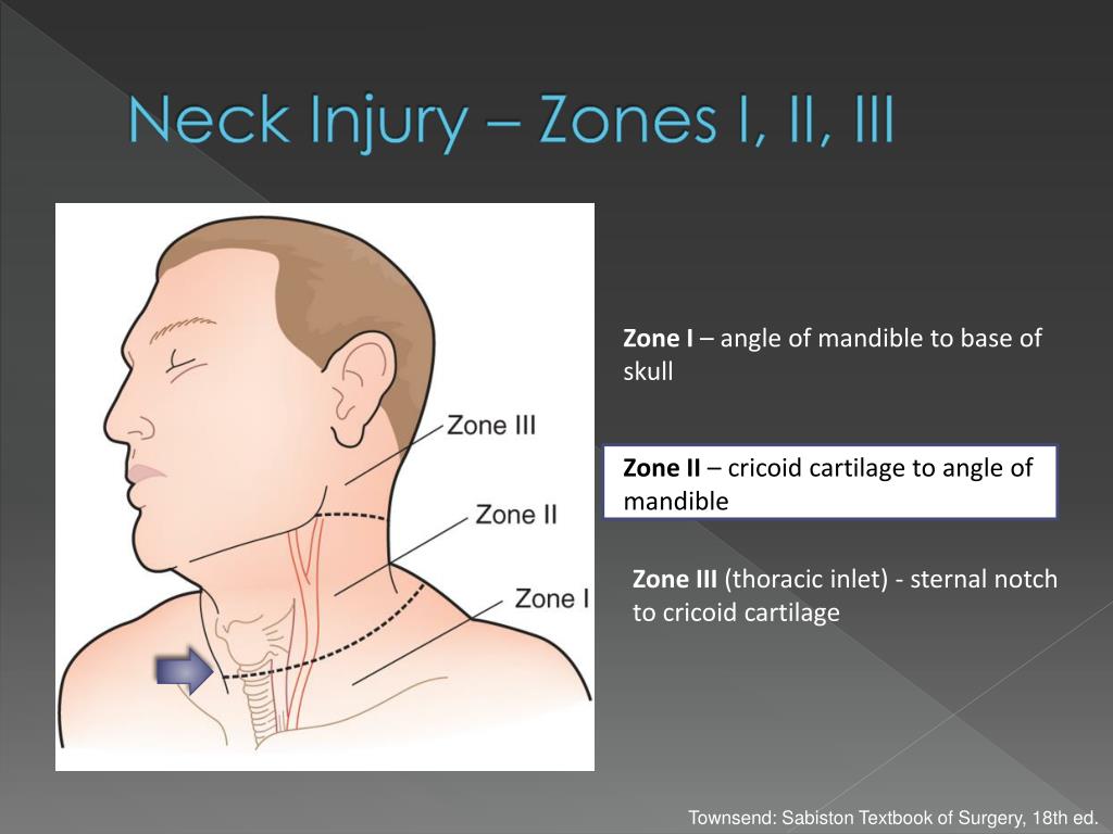 Neck Injury Zones