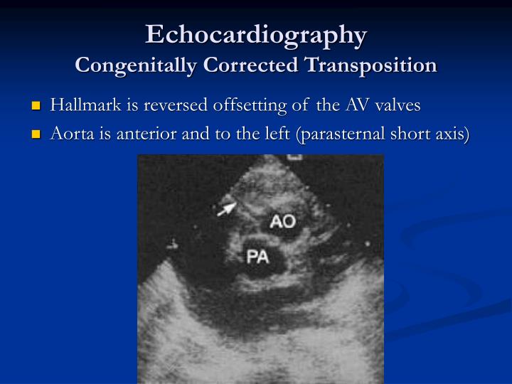 PPT - Transposition of the Great Arteries PowerPoint Presentation - ID ...