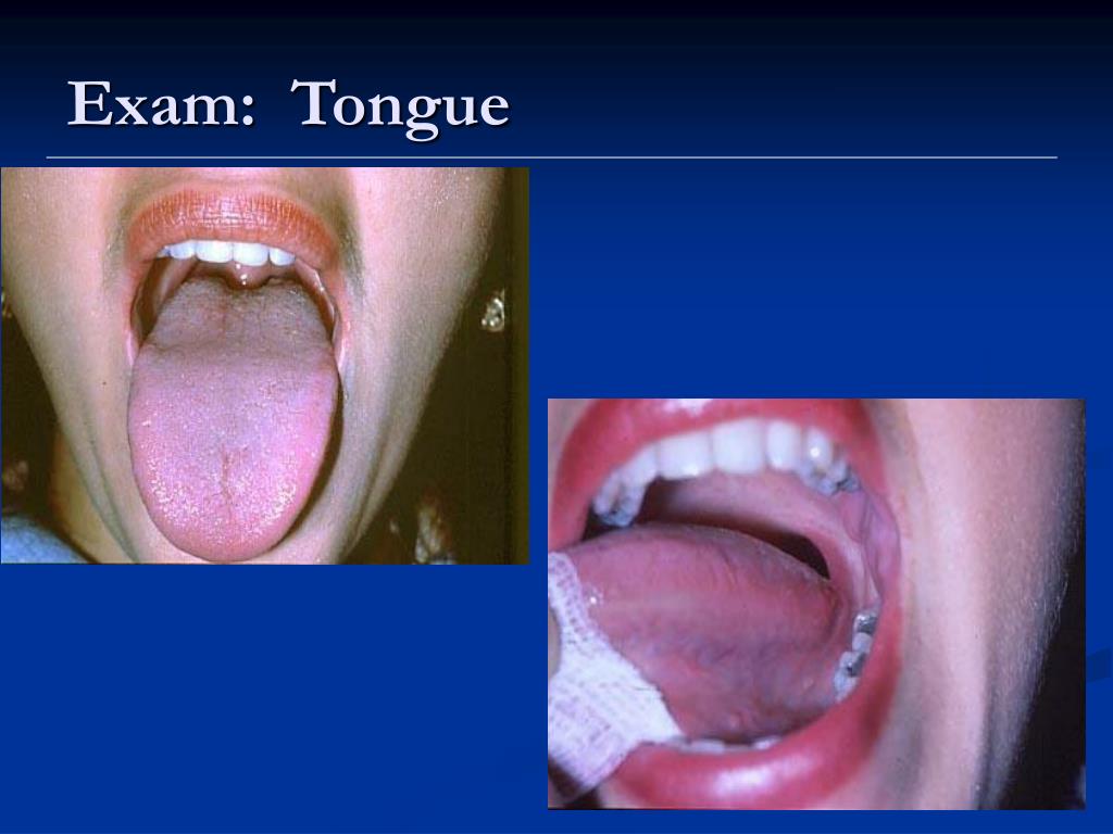 PPT - Examination of the Oral Cavity PowerPoint Presentation, free ...