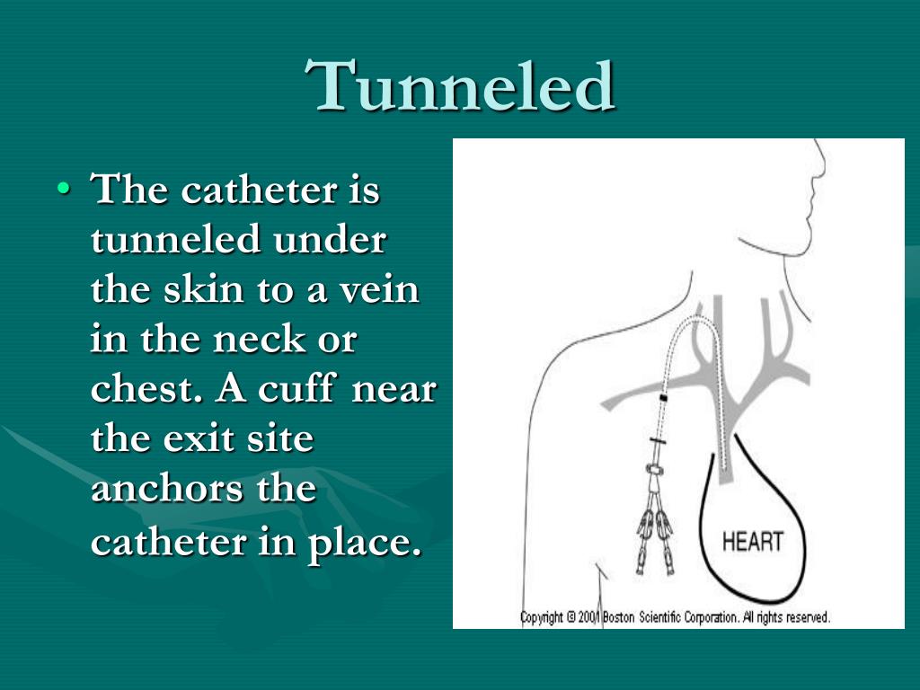 PPT - Venous Access Devices in Clinical Practice PowerPoint ...