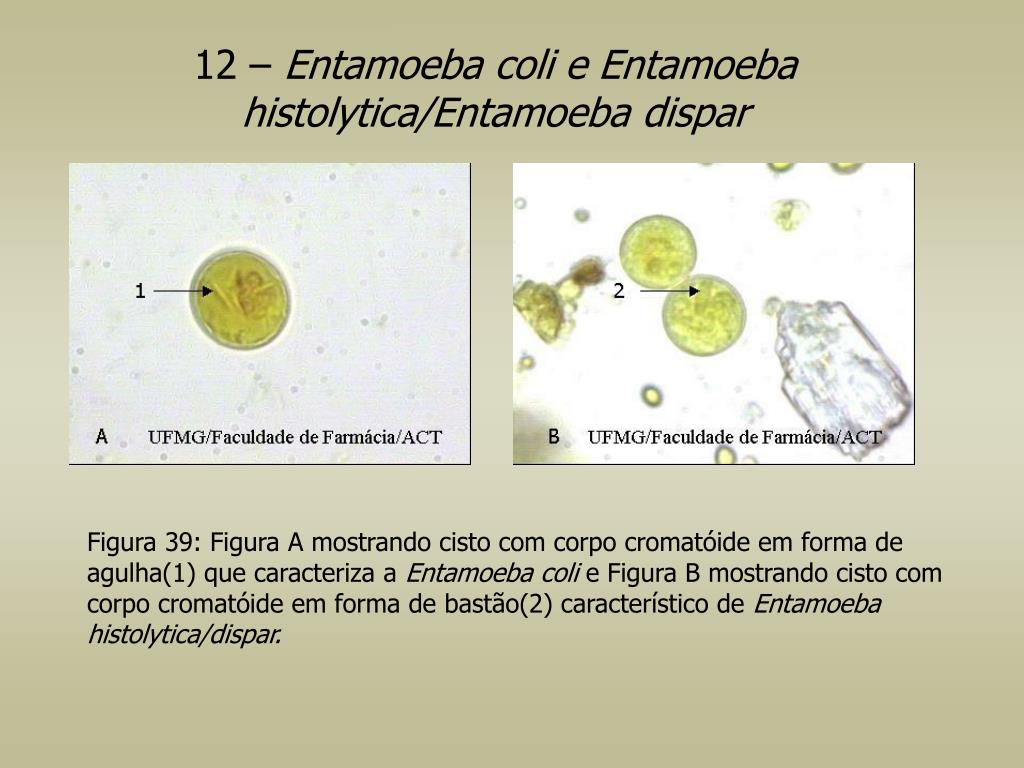 Entamoeba coli в кале. Entamoeba histolytica циста. Цисты Entamoeba. Цисты Entamoeba coli 0 1. Entamoeba coli циста.