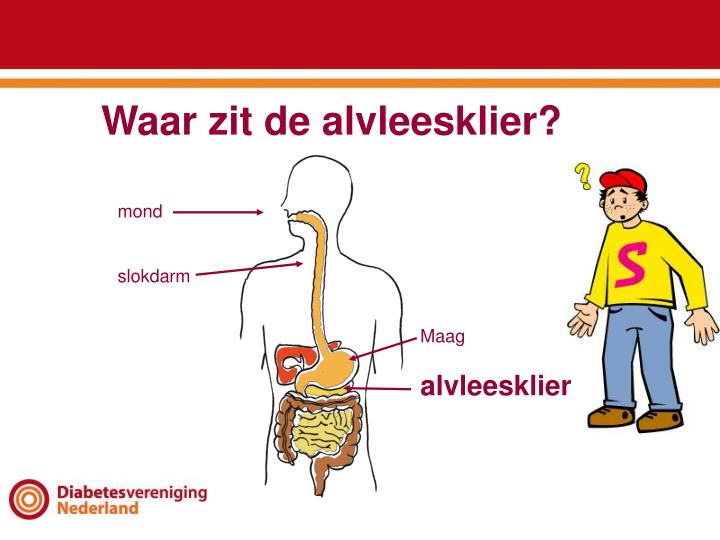 PPT - Mijn spreekbeurt: Wat is diabetes? PowerPoint Presentation - ID