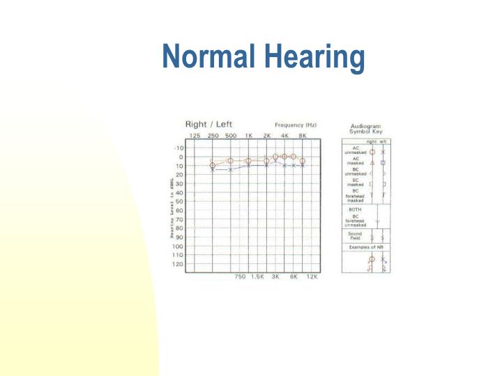 PPT - Introduction to Audiology PowerPoint Presentation - ID:4675976