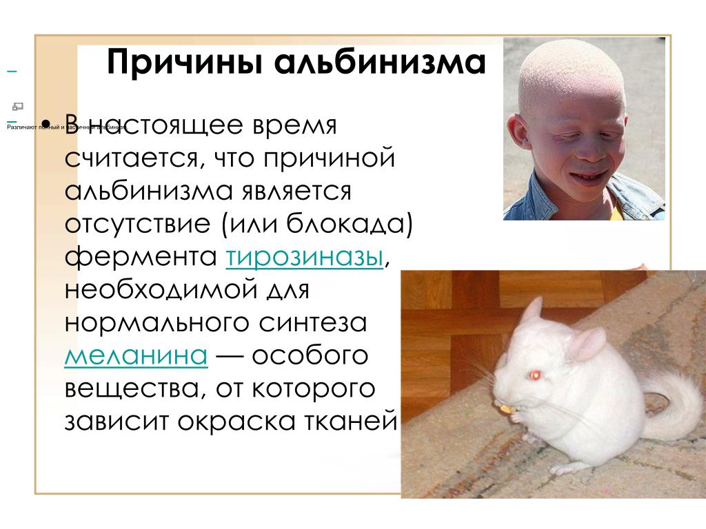 Альбинизмом страдают. Причиной альбинизма является. Альбинизм презентация.