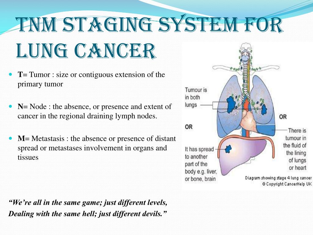 Stages of cancer. TNM 8 lung Cancer. Lung Cancer classification. TNM легкие. Система TNM.