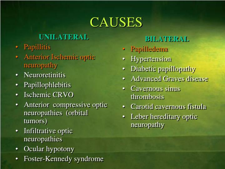 PPT DISC EDEMA PowerPoint Presentation ID4696449