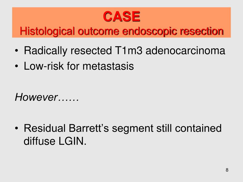 PPT - Novel developments Radiofrequency Ablation (RFA) for dysplastic ...