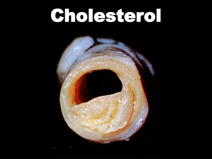 cholesterol n.
