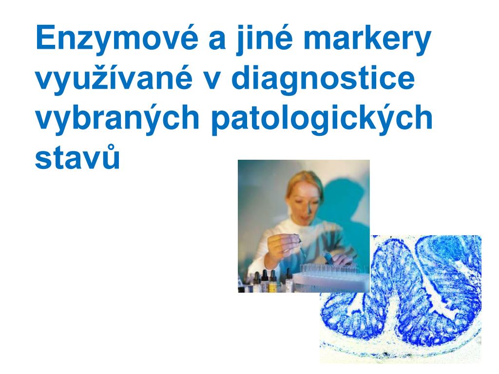 PPT - Enzymové a jiné markery využívané v diagnostice vybraných  patologických stavů PowerPoint Presentation - ID:4706844