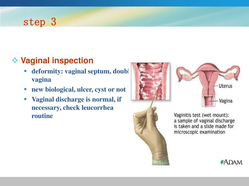 Ppt Gynecological History And Physical Examination Powerpoint