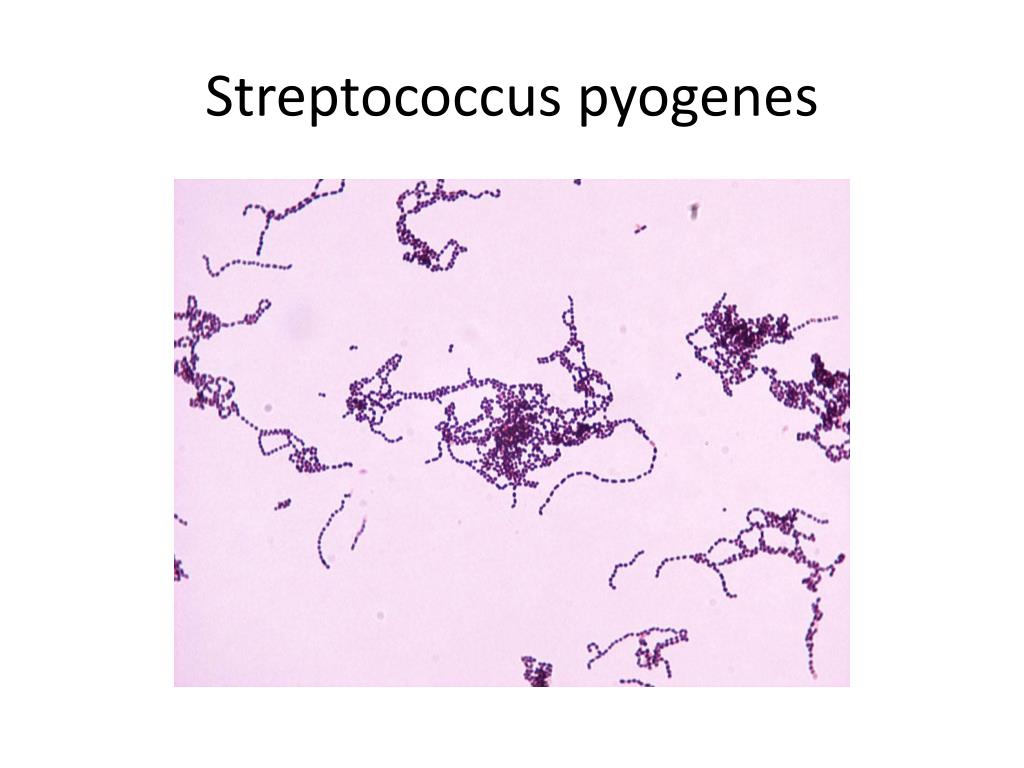 Тест стрептококк группы а. Пиогенный стрептококк возбудитель. Стрептококк пиогенес (Streptococcus pyogenes. Стрептококк микроскопия. Стрептококк группы а возбудитель.