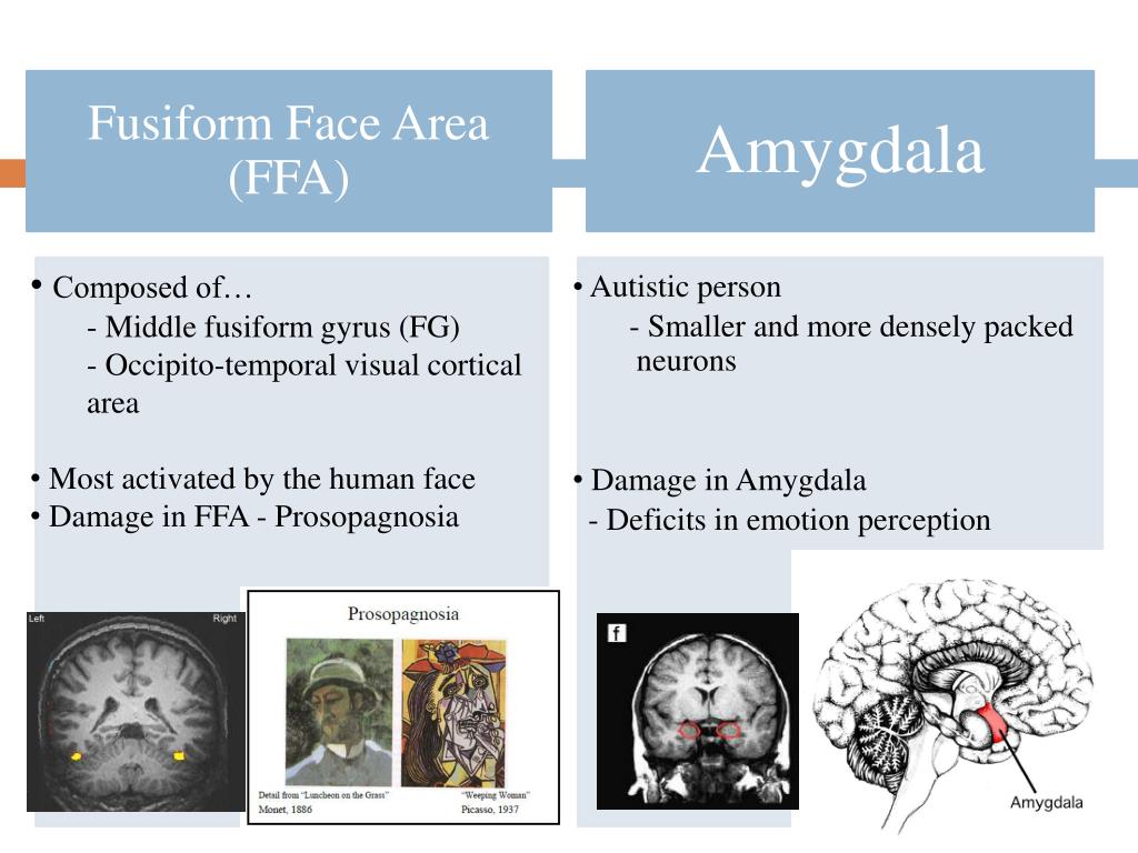 PPT - fMRI Activation of the Fusiform Gyrus and Amygdala to Cartoon ...