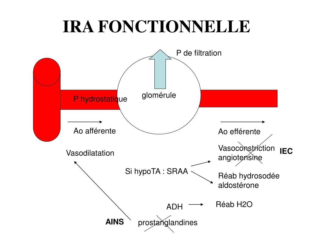 PPT INSUFFISANCES RENALES AIGUES PowerPoint Presentation Free 