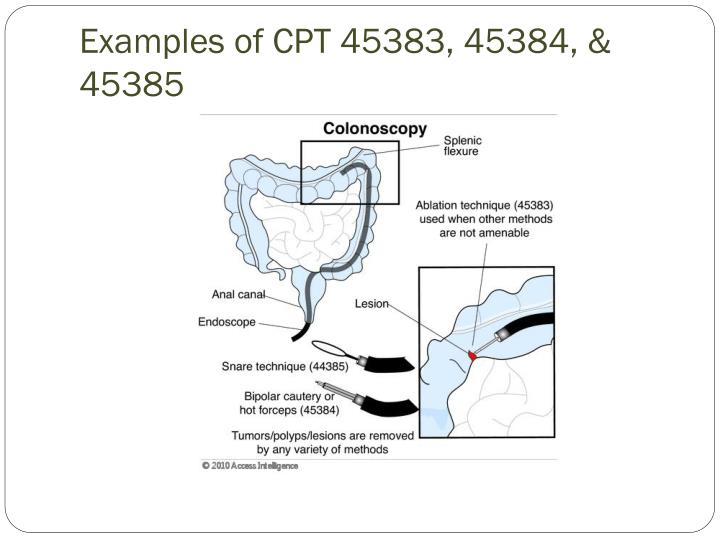 PPT Understanding How to Code Colonoscopies PowerPoint Presentation