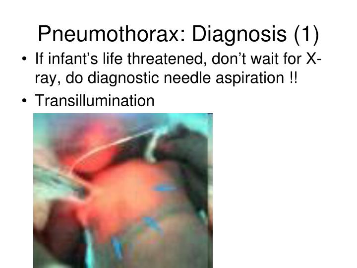 PPT Respiratory Distress in the Newborn, not RDS PowerPoint