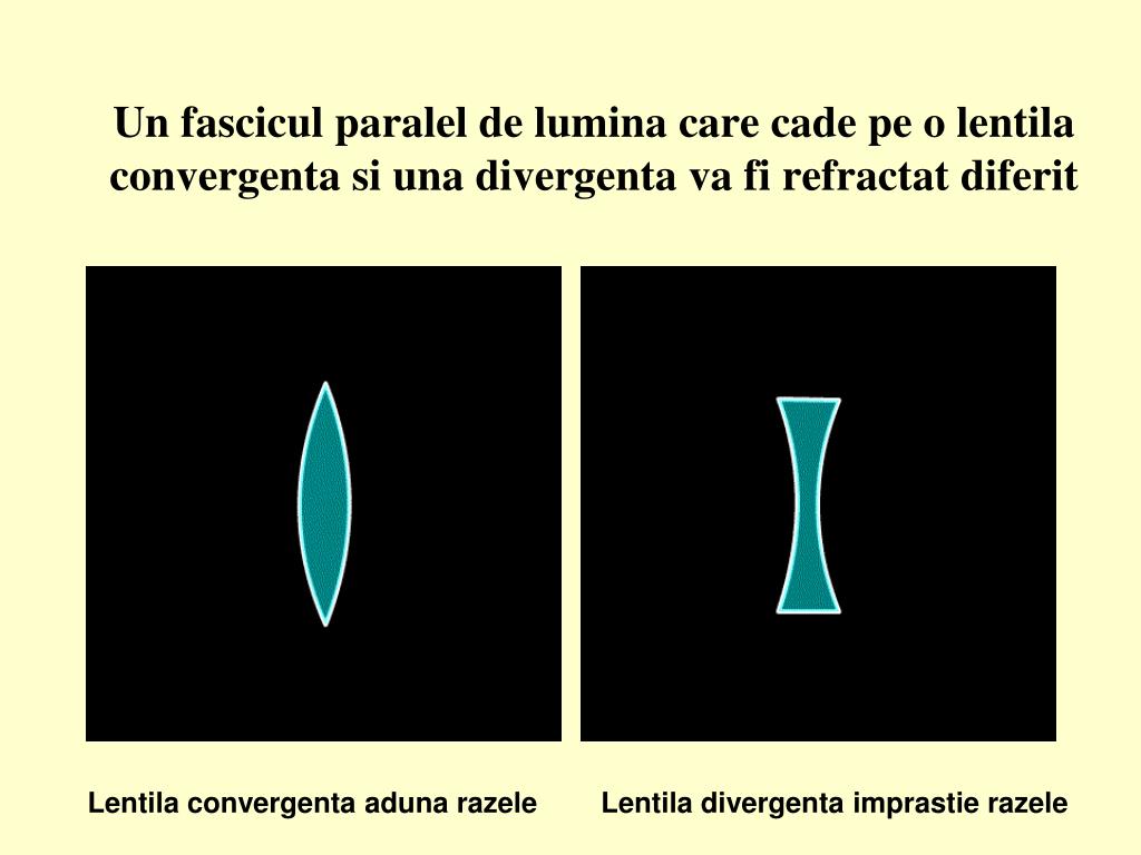 PPT - Lentilele in viata noastra PowerPoint Presentation, free download -  ID:4738252