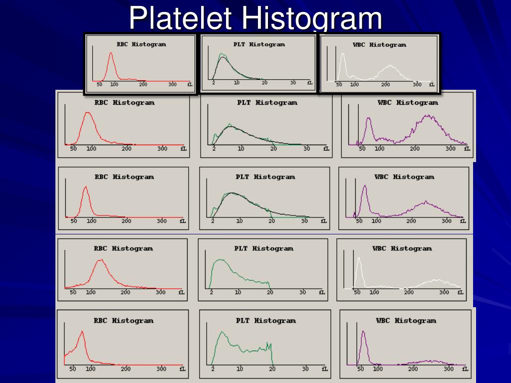Platelet Histogram platelet-histogram