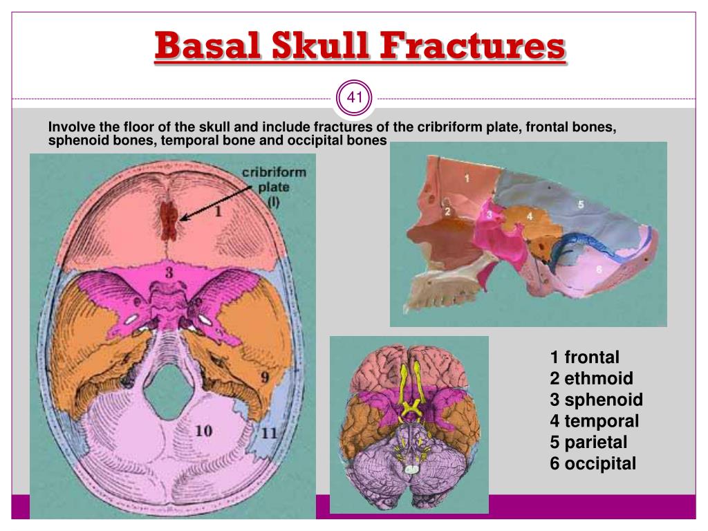 PPT Brain Injury PowerPoint Presentation Free Download ID 4751002