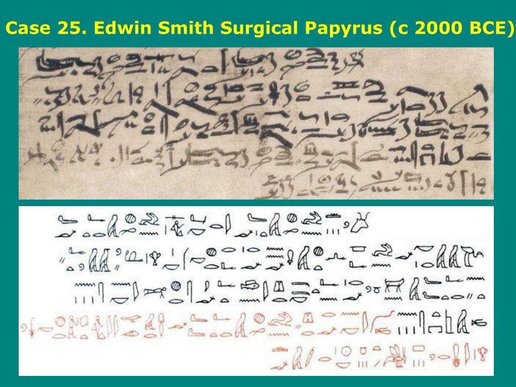 edwin smith papyrus on oligodynamic action edwin smith papyrus on oligodynamic action
