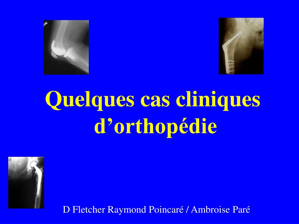PPT - Quelques cas cliniques d'orthopédie PowerPoint Presentation, free  download - ID:4760928